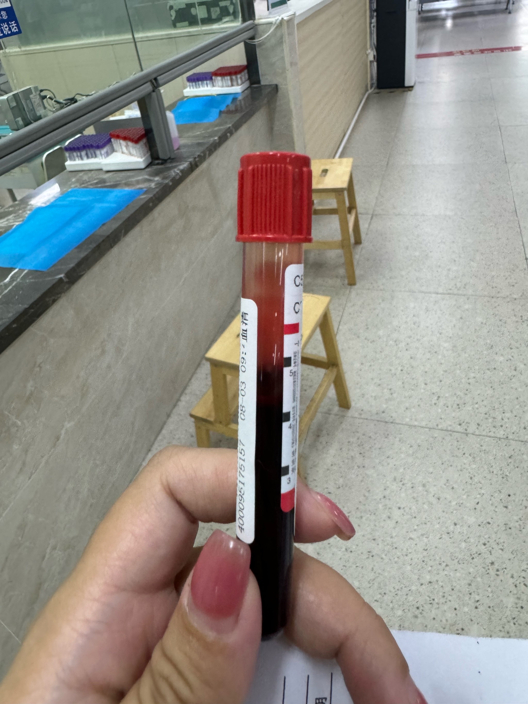 血铅超标有什么症状和危害？儿童与成人血铅中毒表现及影响详解